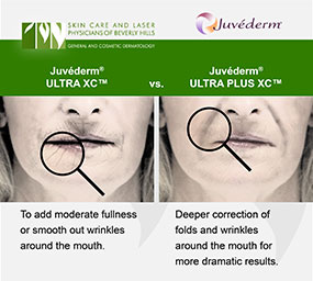 Discover what ULTRA XC and ULTRA Plus XC have in common and what sets them apart in the Juvéderm family at the Los Angeles area's Skin Care and Laser Center of Beverly Hills.